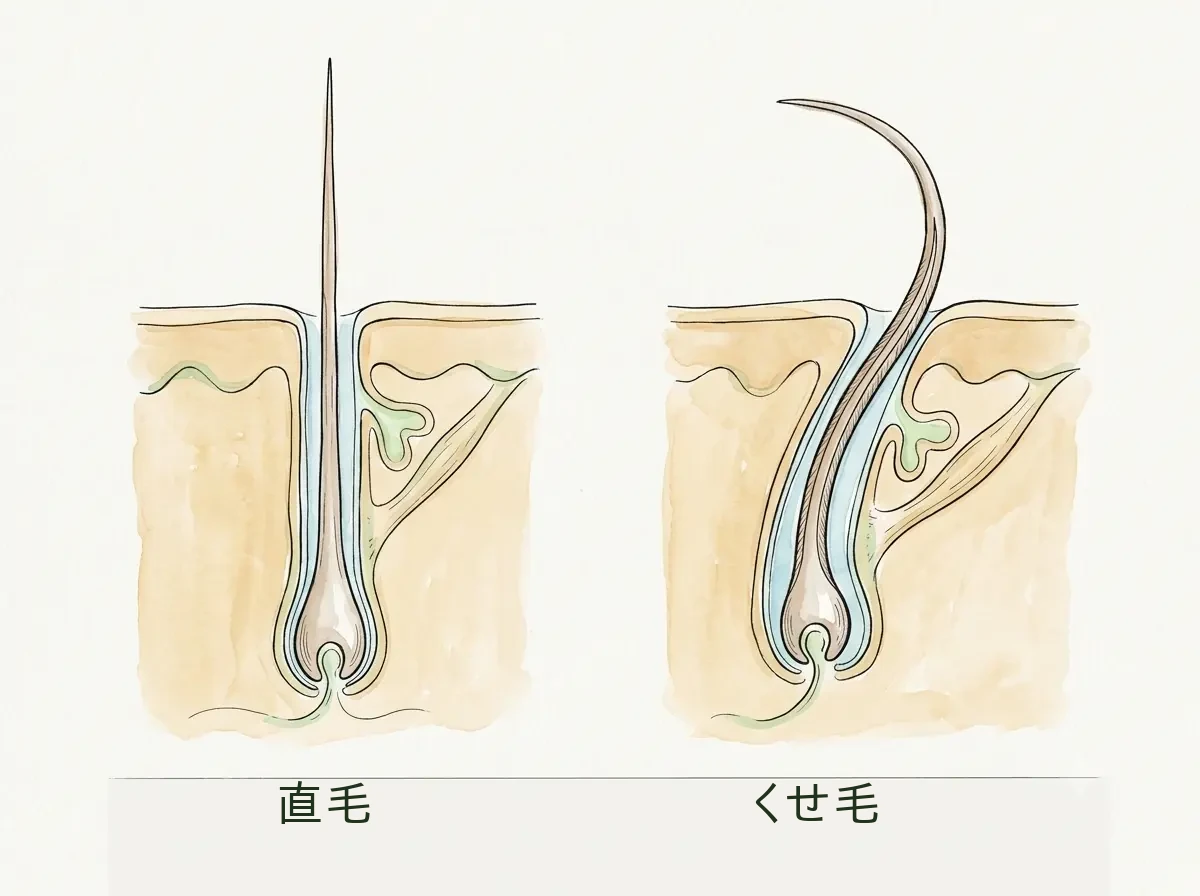 毛を作る筒の形が直毛とくせ毛を分ける——皮膚断面の比較図 皮膚断面の中の毛包を2つ並べて比較する図解。左はまっすぐで左右対称な毛包から直毛が、右は曲がって非対称な毛包からくせ毛が生えている様子を示す